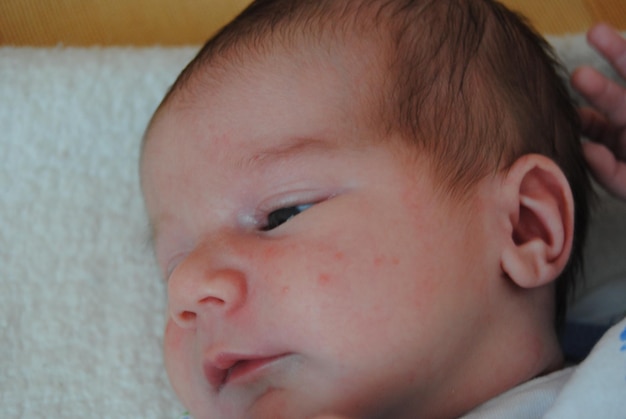 Jak rozpoznać uczulenie u noworodka objawy, na które warto zwrócić uwagę?