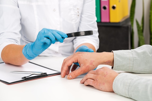 Ile kosztują testy alergiczne i od czego zależy ich cena?