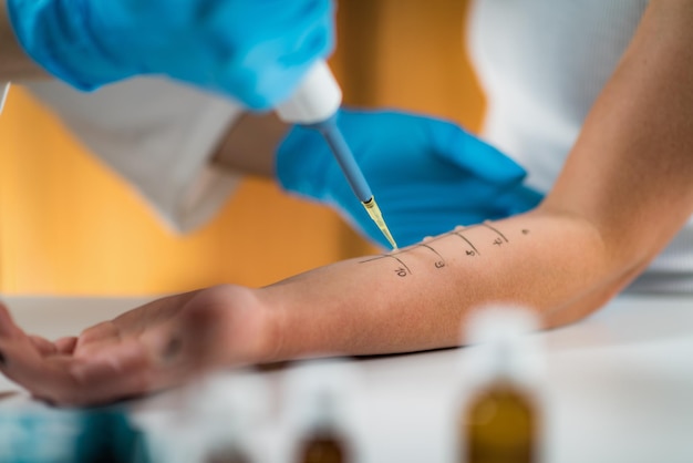 Testy alergiczne czy na czczo są konieczne?